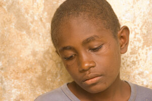 This boy was one of about a dozen who came to Sara airstrip 
to watch our plane land. Most of the time he was laughing and
goofing around as boys are wont to do. But when left to himself,
he quickly became reflective.
I suppose the scars around his eyes may have something to do with that.

